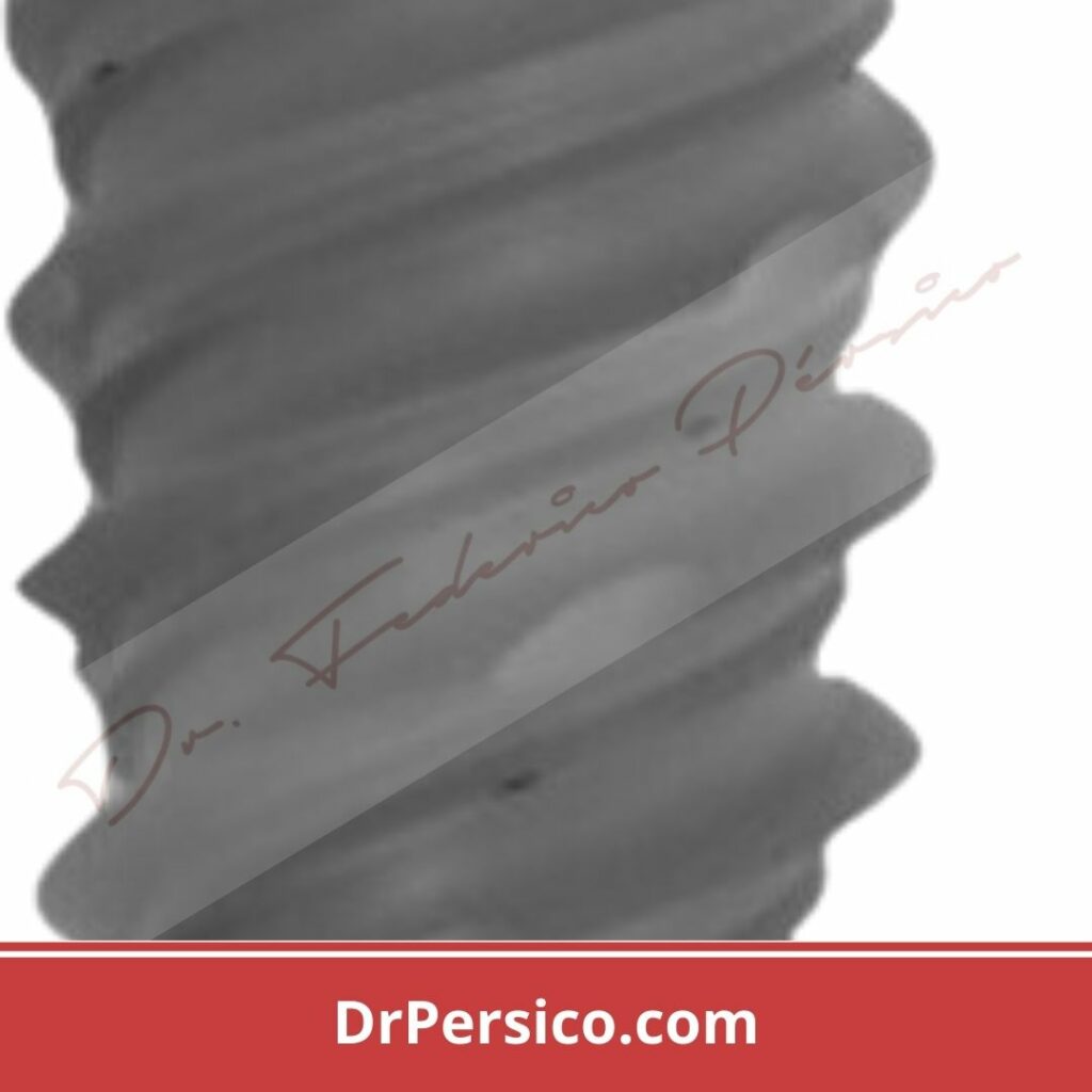 superficie implantes dentales oseointegración