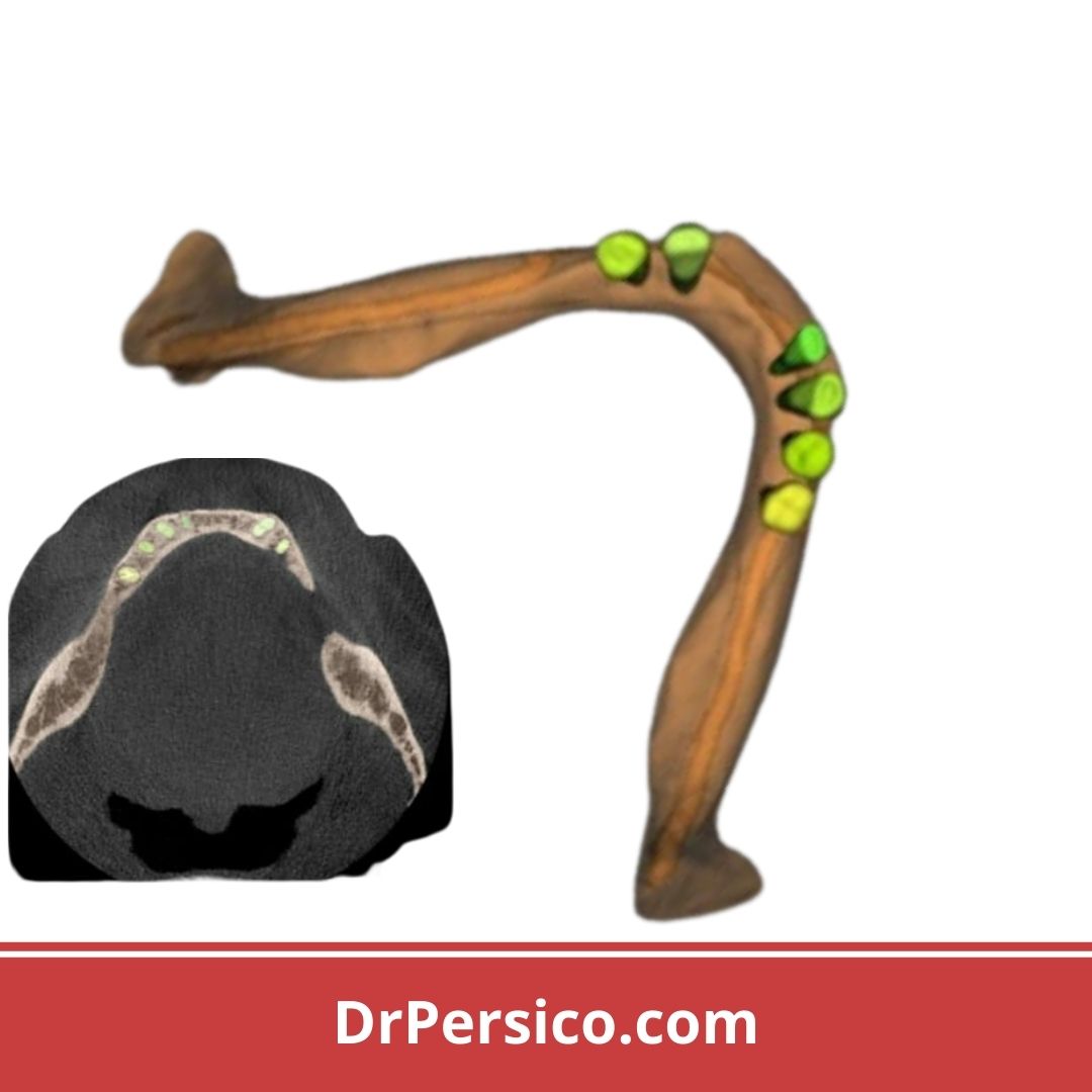 segmentación tomografías CBCT